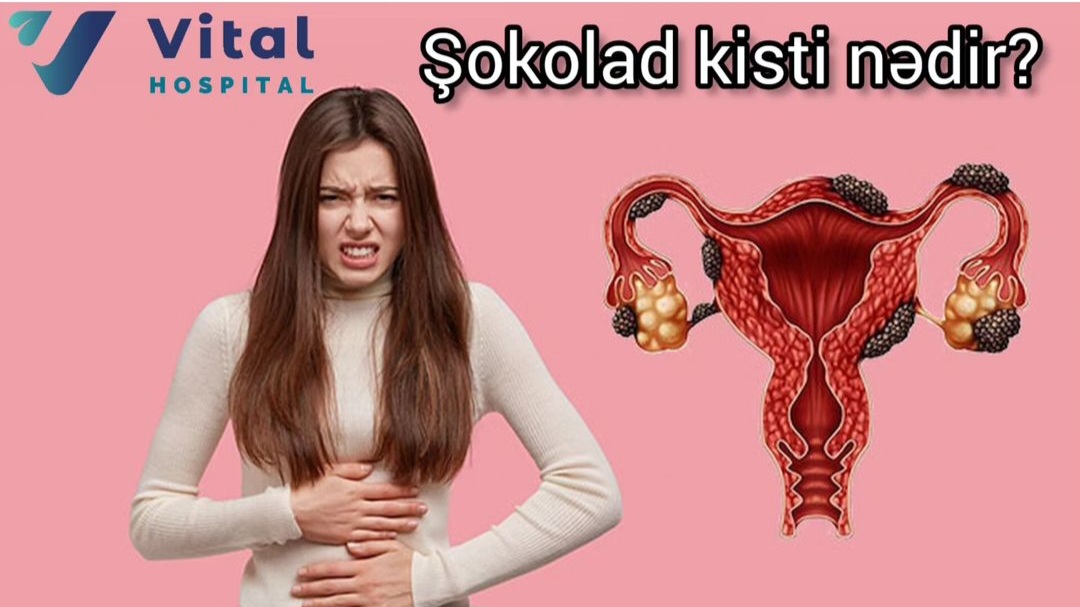 Uşaqlıq boynu eroziyası